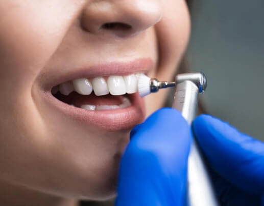 Patient receiving professional dental cleaning