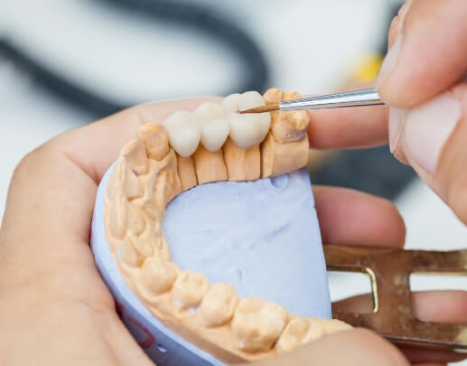 Lab technician crafting a dental crown