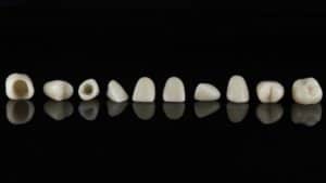 Row of dental crowns in Annapolis against dark background