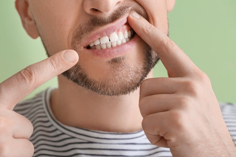 man pointing at teeth and gums.
