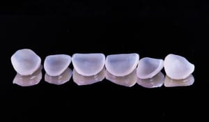 Six veneers sitting in a row on a black surface
